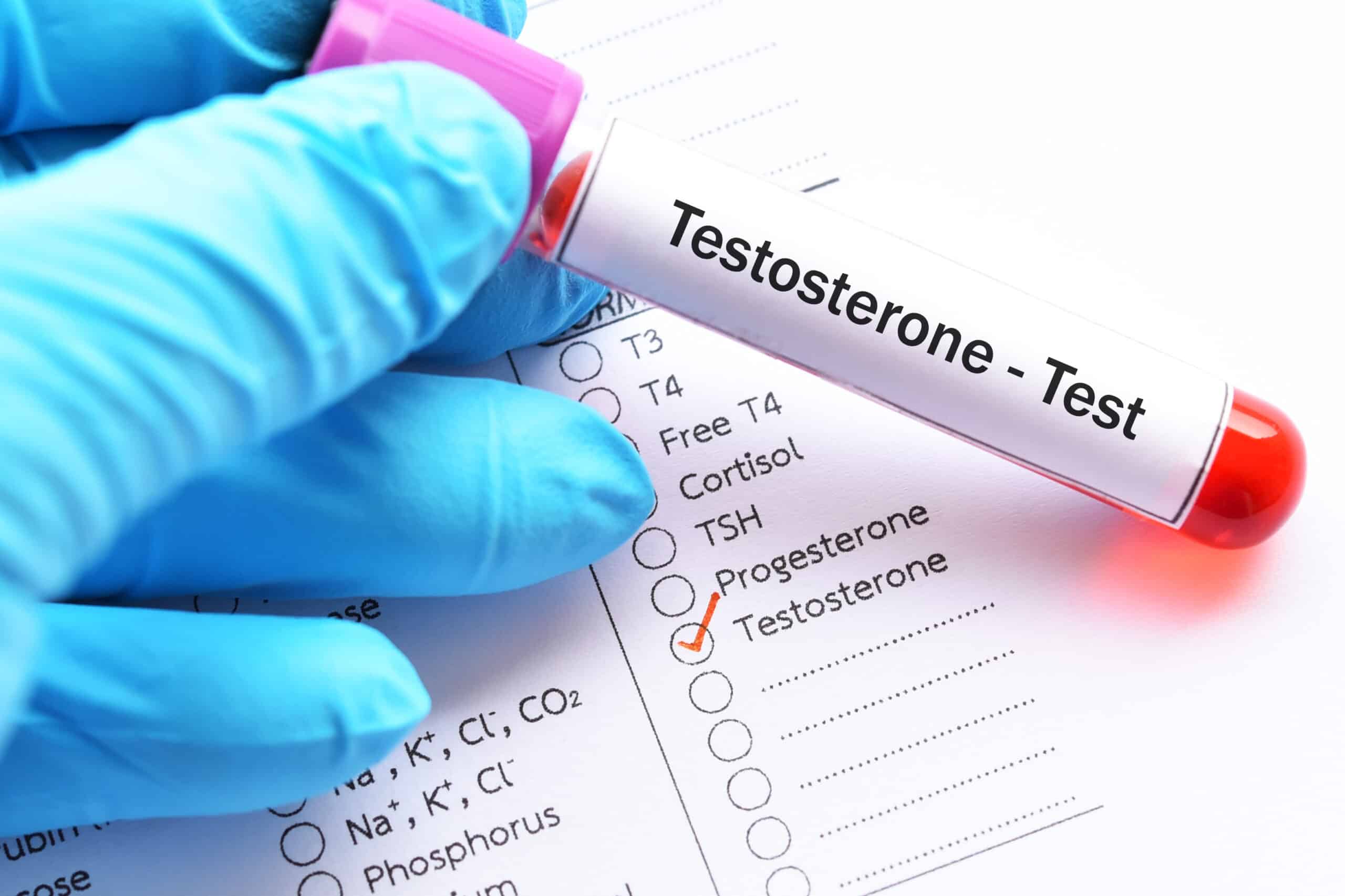 Testosterone Therapy Austin, TX: Boost Energy, Muscle & Vitality